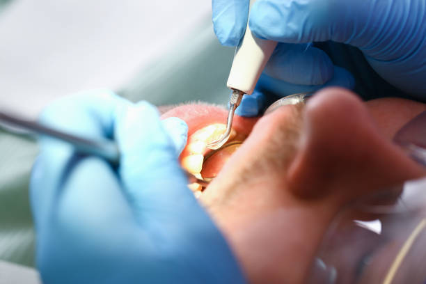 Best Walk-In Dentist Near Me  in Welsh, LA