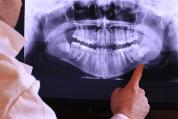 Best Emergency Dental Services Near Me  in Welsh, LA