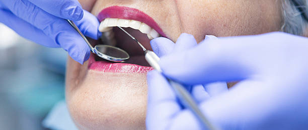 Best Teeth Whitening  in Welsh, LA